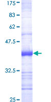 12.5% SDS-PAGE Stained with Coomassie Blue.